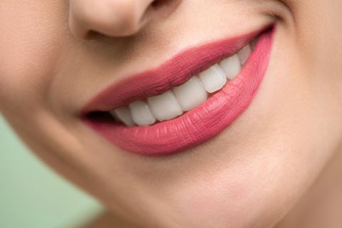 ملاسما چیست و چگونه ایجاد می‌شود؟ چه درمان‌هایی برای آن وجود دارد؟