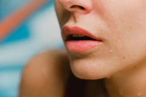 جراحی کوچک کردن لب: عوارض جانبی، اثربخشی، دوران نقاهت جراحی کوچک کردن لب: عوارض جانبی، اثربخشی، دوران نقاهت