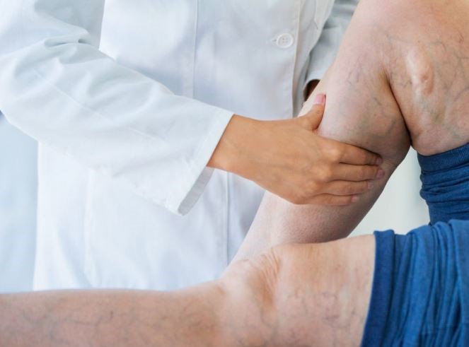 سلولیت چیست و چگونه می توان آن کاهش داد؟