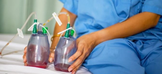 لیپوساکشن: آنچه از خطرات، مزایا، روش‌ها و نتایج آن باید بدانیم. 