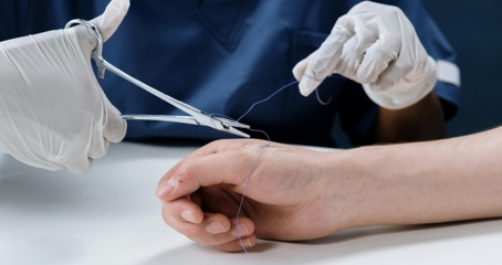 بخیه‌های قابل جذب چه هستند و چه مزایا و معایبی دارند؟