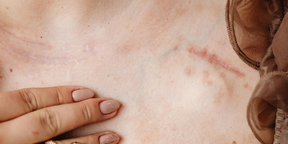 هشدار آکادمی چشمپزشکی آمریکا در مورد خطرات جراحیهای تغییر رنگ چشم هشدار آکادمی چشمپزشکی آمریکا در مورد خطرات جراحیهای تغییر رنگ چشم