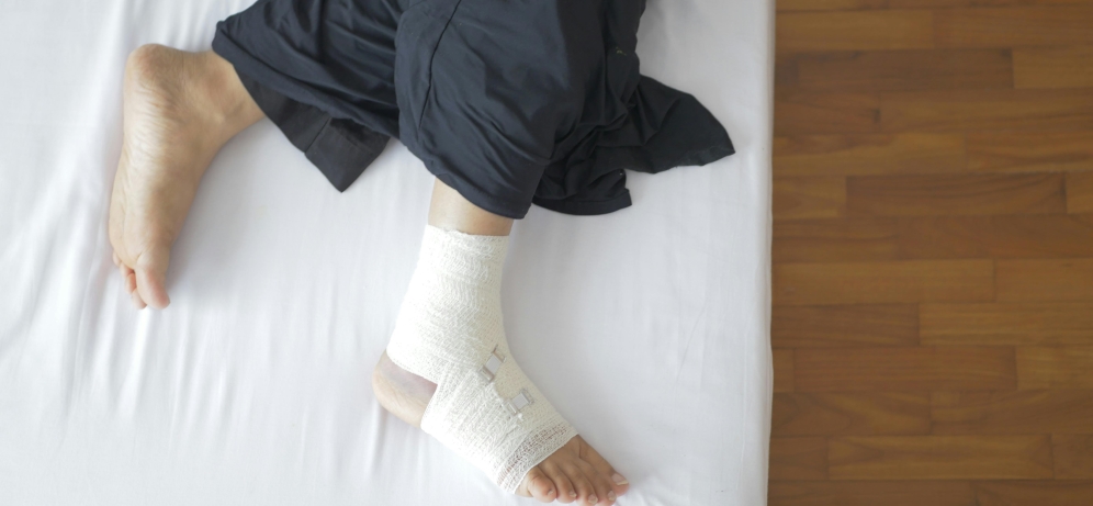 عمل کوچک کردن سینه یا ماموپلاستی کاهشی: از قبل و بعد این عمل بدانیم