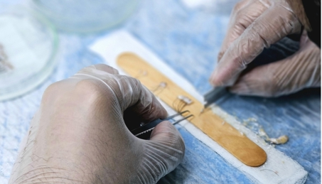 <h2 dir="RTL" style="text-align: justify;"><b><span>آیا نتایج کاشت مو در ترکیه واقعی هستند؟</span></b></h2>
<p dir="RTL" style="text-align: justify;"><span>دست‌کاری یا ویرایش عکس‌ها محدود به منطقه‌ی خاصی نیست و می‌توان منطقی دانست که برخی از کلینیک‌های کاشت موی ترکیه، عکس‌های قبل و بعد از کاشت مو را تغییر دهند، در حالی که برخی دیگر ممکن است از تصاویر ویرایش‌نشده استفاده کنند. </span><span>در عین حال، برخی بیماران پس از کاشت مو در ترکیه به نتایج چشمگیری دست یافته‌اند.<b> بنابراین، بسیار مهم است که اصالت تصاویر تبلیغاتی را به دقت بررسی کنید، چراکه ممکن است این تصاویر با هدف جذب گردشگران درمانی تهیه و تنظیم شده باشند</b></span><b><span dir="LTR">.</span></b></p>
<p dir="RTL" style="text-align: justify;"><span>پیش از تصمیم‌گیری بر اساس عکس‌ها، اطمینان حاصل کنید که منبع معتبر است و نتایج نمایش‌داده‌شده با خط رویش طبیعی و ظاهر کلی بیمار هم‌خوانی دارد</span><span dir="LTR">.</span><span> یک جراح ماهر و دارای بورد تخصصی، درباره‌ی نتایج خود شفاف عمل می‌کند و نمونه‌های متعدد قبل و بعد را، ترجیحاً از چند زاویه، در اختیار شما قرار می‌دهد</span><span dir="LTR">.</span><span> اگر نتایج کلینیکی در ترکیه بیش از حد عالی و غیرواقعی به نظر می‌رسند، احتمالاً همین‌طور است یعنی غیر واقعی است.</span></p>
<h2 dir="RTL" style="text-align: justify;"><b><span>خطرات کاشت مو در ترکیه چیست؟</span></b><b></b></h2>
<p dir="RTL" style="text-align: justify;"><span>ترکیه به انجام «تغییرات ظاهری افراطی» معروف است؛ یعنی انجام چندین عمل کاشت مو در یک جلسه؛ رویکردی که از نظر کارایی و هزینه جذاب به نظر می‌رسد اما می‌تواند خطرناک باشد. </span><span>روش‌های طولانی‌مدت و تهاجمی‌تر در کاشت مو، احتمال بروز خون‌ریزی زیاد، مسمومیت با لیدوکائین و درد پس از عمل را افزایش می‌دهند. </span><span>همچنین، زمانی که کاشت مو با تعداد زیاد گرافت در یک جلسه انجام شود، خطر از دست رفتن غیرقابل‌بازگشت گرافت‌ها به دلیل کاهش خون‌رسانی و التهاب بالا وجود دارد</span><span dir="LTR">.</span></p>
<p dir="RTL" style="text-align: justify;"><span>بسیاری از متخصصان کاشت مو باور دارند که انجام مرحله‌ای عمل‌ها در طول زمان، به نتایج بهتر و پایدارتر منجر می‌شود و خطرات و عوارض ناشی از «مگاسشن‌ها» (جلسات سنگین و طولانی کاشت مو) که در ترکیه رایج‌اند را کاهش می‌دهد. </span><span>از آنجا که هنوز کارآزمایی‌های بالینی گسترده‌ای برای مقایسه‌ی رویکردهای مختلف جراحی در کاشت مو انجام نشده است، بیماران باید به تخصص و تجربه‌ی جراحان تکیه کنند. </span><span>این امر غیرعادی نیست که برخی بیماران از ترکیه با نتایج رضایت‌بخش بازگردند، همان‌طور که تعجب‌آور نیست اگر برخی دیگر برای انجام جراحی ترمیمی یا اصلاحی، پس از تجربه‌ی عوارض یا نتایج نامطلوب، به جراحان مستقر در ایالات متحده مراجعه کنند</span><span dir="LTR">.</span></p>
<h2 dir="RTL" style="text-align: justify;"><b><span>سفر برای جراحی: خطرات چیست؟</span></b></h2>
<p dir="RTL" style="text-align: justify;"><span>یکی از دلایل اصلی سفر بیماران به ترکیه برای کاشت مو، مقرون‌به‌صرفه بودن هزینه‌هاست. با این حال، انجام درمان‌های ریزش مو در خارج از ایالات متحده خطرات خاص خود را دارد</span><span dir="LTR">:</span></p>
<ul type="disc" style="text-align: justify;">
<li dir="RTL"><b><span>فقدان مراقبت پیگیری</span></b><b><span dir="LTR">:</span></b><span dir="LTR"><br></span><span>یافتن جراحی محلی که حاضر به ادامه‌ی مراقبت از بیمار در صورت بروز عارضه باشد دشوار است. بسیاری از جراحان آمریکایی تمایل ندارند عوارض ناشی از جراحی‌هایی که در خارج انجام شده را درمان کنند</span><span dir="LTR">.</span></li>
<li dir="RTL"><b><span>تفاوت در استانداردهای ایمنی</span></b><b><span dir="LTR">:</span></b><span dir="LTR"><br></span><span>مقررات پزشکی در کشورها متفاوت است. هرچند ترکیه دارای جراحان مجرب و کلینیک‌های معتبر است، اما کاشت موهای ارزان‌قیمت در این کشور ممکن است با نظارت و ضوابط کمتری انجام شود. بنابراین، وظیفه‌ی بیمار است که درباره‌ی کلینیک و جراح مورد نظر خود به‌دقت تحقیق کند</span><span dir="LTR">.</span></li>
<li dir="RTL"><b><span>محدودیت در حمایت‌های قانونی</span></b><b><span dir="LTR">:</span></b><span dir="LTR"><br></span><span>قوانین فدرال و ایالتی ایالات متحده در مورد جراحی‌های انجام‌شده در خارج از کشور اعمال نمی‌شوند. اگر مشکلی پیش بیاید، گزینه‌های شما یا خانواده‌تان برای پیگیری قانونی ممکن است محدود باشد</span><span dir="LTR">.</span></li>
</ul>
<p dir="RTL" style="text-align: justify;"><span>بیشتر جراحان زیبایی در ایالات متحده گزینه‌ی <b>تأمین مالی جراحی زیبایی</b> را ارائه می‌کنند، که به بیماران اجازه می‌دهد هزینه‌ی عمل را به صورت اقساط ماهانه پرداخت کنند تا بتوانند جراحی زیبایی ایمن‌تری را با هزینه‌ی قابل‌مدیریت‌تر انجام دهند</span><span dir="LTR">.</span></p>
<h2 dir="RTL" style="text-align: justify;"><b><span>علائم هشدار هنگام انتخاب جراح و کلینیک کاشت مو</span></b><b></b></h2>
<p dir="RTL" style="text-align: justify;"><span>بیماران باید هنگام انتخاب جراح زیبایی برای کاشت مو، نسبت به موارد زیر هوشیار باشند</span><span>به‌ویژه در صورتی که قصد انجام کاشت مو در ترکیه را دارند</span></p>
<ul>
<li dir="RTL" style="text-align: justify;"><b><span>تبلیغات و بازاریابی بیش از حد تهاجمی</span></b></li>
</ul>
<p dir="RTL" style="text-align: justify;"><span>بیماران کاشت مو اغلب در معرض فشارهای تبلیغاتی از سوی «مشاورانی» قرار می‌گیرند که پزشک نیستند و از هر قرارداد سود مالی می‌برند</span><span dir="LTR">.</span><span> این افراد ممکن است بدون ارزیابی دقیق نیاز بیمار، او را به انجام عمل خاصی ترغیب کنند؛ از کلینیک‌هایی که فروش را بر آموزش و برنامه‌ریزی درمانی شخصی‌شده ترجیح می‌دهند دوری کنید</span><span dir="LTR">.</span></p>
<ul>
<li dir="RTL" style="text-align: justify;"><b><span>عدم شفافیت درباره‌ی نتایج بلندمدت</span></b><b></b></li>
</ul>
<p dir="RTL" style="text-align: justify;"><span>کاشت موی</span><span dir="LTR"> FUE </span><span>در ترکیه روند ریزش موی پیشرونده را متوقف نمی‌کند. جراحان اخلاق‌مدار باید انتظارات واقع‌بینانه را بر اساس وضعیت فردی شما تنظیم کنند و چشم‌اندازی جامع از نتایج احتمالی ارائه دهند. </span><span>همچنین، جراح باید توضیح دهد که آیا برای رسیدن به نتیجه‌ی مطلوب به عمل‌های تکمیلی یا درمان‌های مداوم نیاز خواهید داشت یا خیر</span><span dir="LTR">.</span><span> بررسی مقررات پزشکی، مدارک جراح و اعتبارسنجی مراکز درمانی در خارج از کشور ممکن است چالش‌برانگیز باشد</span><span dir="LTR">.</span></p>
<ul>
<li dir="RTL" style="text-align: justify;"><b><span>ارتباط اندک یا عدم ملاقات با جراح پیش از عمل</span></b><b></b></li>
</ul>
<p dir="RTL" style="text-align: justify;"><span>اگر کلینیکی فقط از طریق نمایندگان فروش با شما ارتباط دارد یا اجازه‌ی ملاقات با جراح اصلی پیش از رزرو عمل را نمی‌دهد، این نشانه‌ی ضعف در کیفیت خدمات است</span><span dir="LTR">.</span><span> شما باید در جلسه‌ی مشاوره‌ای جامع با همان جراحی که عمل را انجام خواهد داد شرکت کنید تا او مستقیماً وضعیت شما را ارزیابی و تمام گزینه‌های درمانی موجود</span><span>از جمله <b>استخراج واحد فولیکولی</b></span><b><span dir="LTR"> (FUE)</span></b><b><span>، کاشت مستقیم مو</span></b><b><span dir="LTR"> (DHI)</span></b><b><span>، پیوند واحد فولیکولی</span></b><b><span dir="LTR"> (FUT)</span></b><span>و گزینه‌های غیرجراحی (که روزبه‌روز مؤثرتر می‌شوند) را با شما مرور کند</span><span dir="LTR">.</span></p>
<ul>
<li dir="RTL" style="text-align: justify;"><b><span>مدارک و تجربه‌ی تأییدنشده</span></b><b></b></li>
</ul>
<p dir="RTL" style="text-align: justify;"><span>برخی کلینیک‌های کاشت مو ممکن است از پزشکان عمومی یا افراد کم‌تجربه برای انجام عمل استفاده کنند. </span><span>بیماران باید همیشه گواهی تخصص، آموزش و تجربه‌ی جراح را در زمینه‌ی کاشت مو بررسی کنند تا از صلاحیت او برای انجام ایمن عمل و ارائه‌ی نتایج طبیعی اطمینان یابند</span><span dir="LTR">.</span></p>
<ul>
<li dir="RTL" style="text-align: justify;"><b><span>مراکز جراحی فاقد اعتبار رسمی</span></b><b></b></li>
</ul>
<p dir="RTL" style="text-align: justify;"><span>عمل کاشت مو باید در کلینیک‌های معتبر و دارای مجوز انجام شود که از استانداردهای بالا در زمینه‌ی ایمنی و بهداشت پیروی می‌کنند. </span><span>محیط جراحی به‌اندازه‌ی مهارت جراح اهمیت دارد. مراکز بدون اعتبار ممکن است فاقد تجهیزات کافی، کارکنان آموزش‌دیده یا پروتکل‌های اضطراری مناسب برای مقابله با عوارض باشند</span><span dir="LTR">.</span></p>
<p dir="RTL" style="text-align: justify;"><span>اگر در حال بررسی کاشت مو</span><span>چه در کشور خودتان و چه در خارج</span><span>هستید، بسیار مهم است که جراحی باتجربه را انتخاب کنید که زمان کافی را برای بررسی علت خاص ریزش موی شما صرف کند و تمام گزینه‌های درمانی موجود را با شما در میان بگذارد تا تصمیمی آگاهانه بگیرید</span><span dir="LTR">.<br></span><span>اگر احساس کردید در حال «وادار شدن به خرید» هستید تا «راهنمایی برای تصمیم»، حتی در بهترین کلینیک‌های کاشت موی ترکیه، بهتر است به گزینه‌های نزدیک‌تر به محل زندگی خود فکر کنید</span><span dir="LTR">.</span></p>
<div class="content-tip-box">
<div class="header"><i class="bi bi-star-fill fs-4"></i> نکته</div>
<p><span>مطالب این سایت صرفاً جهت اطلاع‌رسانی است و نباید به عنوان جایگزینی برای تشخیص، تجویز یا درمان پزشکی در نظر گرفته شود. برای مشکلات پزشکی، حتماً با پزشک متخصص مشورت کنید.</span><span dir="LTR"></span></p>
</div>